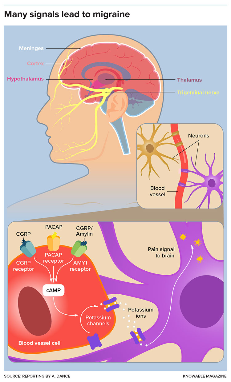 Many signals lead to migraine infographic