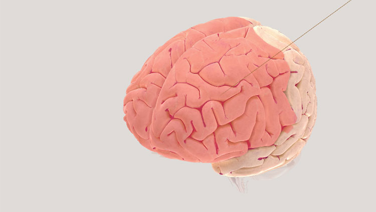 Frontal lobe 3D brain screenshot