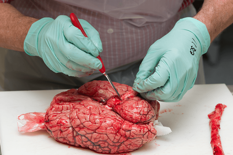 A Step-by-Step Look at How Human Brains Are Prepped for Research