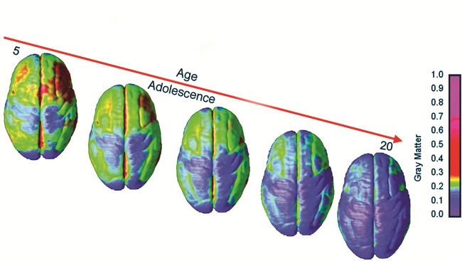 Hormones And The Adolescent Brain - 