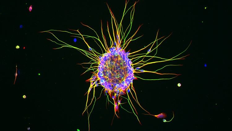 meet the smallest and most common type of nerve cell.