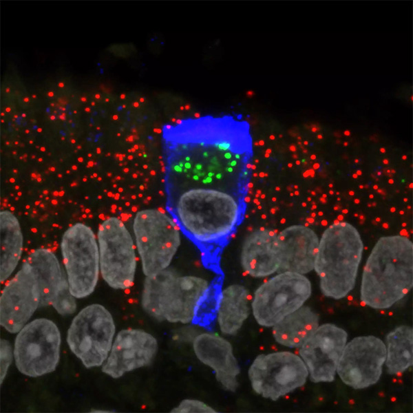 A micrograph showing a piece of olfactory epithelium